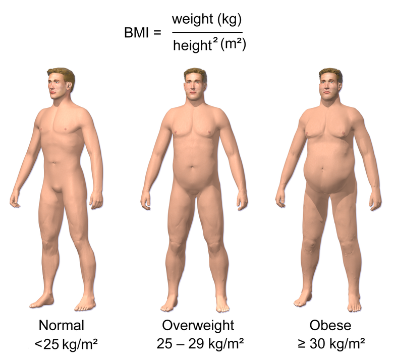 785px-Obesity_&amp;_BMI